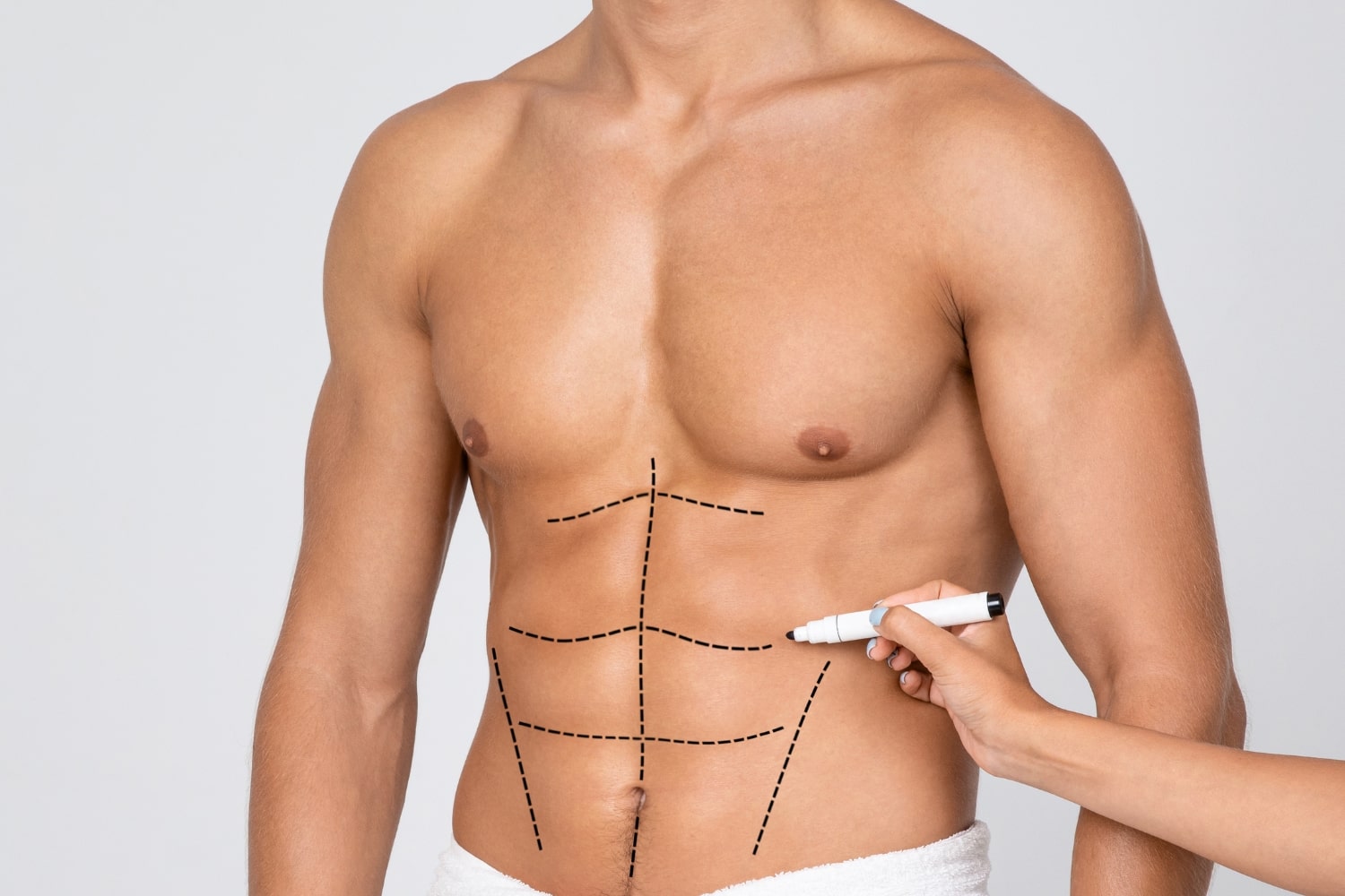 Липоскульптурирование для мужчин